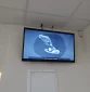 Reklaminiai ekranai VŠĮ Šiaulių centro poliklinikoje